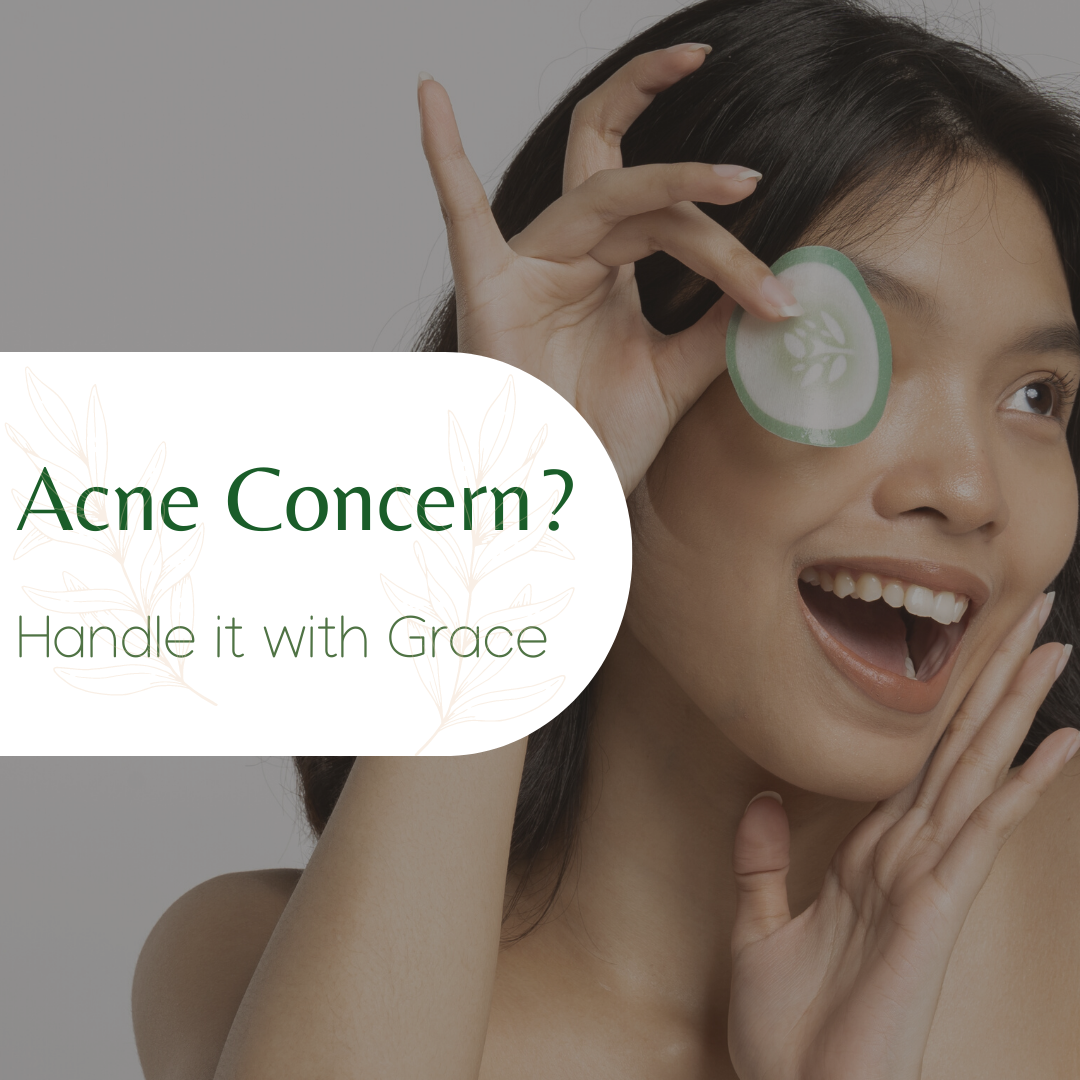 Acne Concern? Handle it with grace.